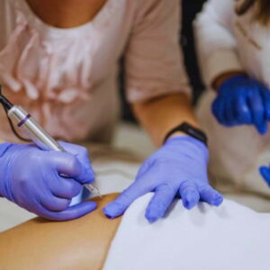 laser-estetica